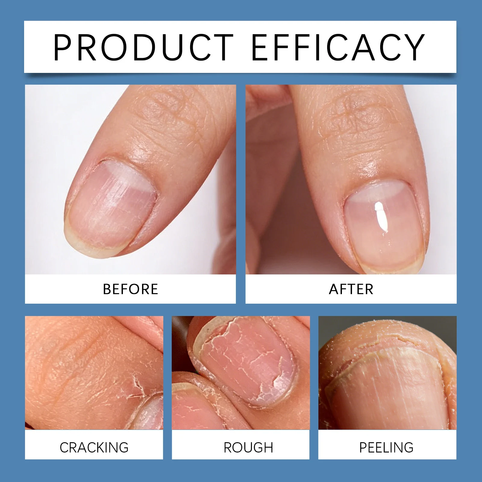 Laniska Nighttime Nail Repair Patches for Brittle & Discolored Nails, 8-Hour Nourishment 9 nighttime nail repair patches lan c4zpn5qr desc 9